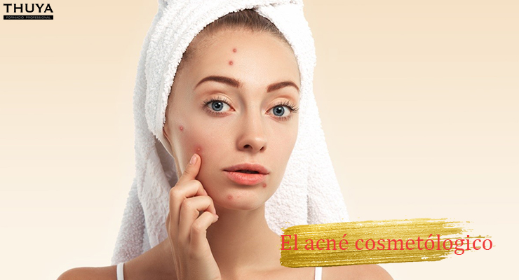El acné cosmetológico