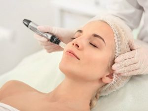 Los beneficios del dermapen