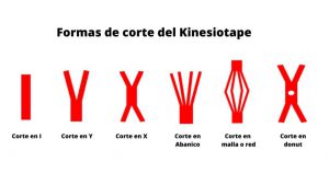 se muestran los diferentes tipos de corte para colocar kineiotape